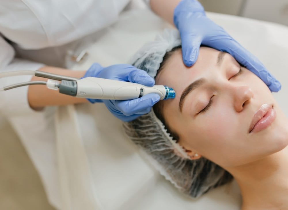 Cum funcționează tratamentele faciale cu laser și ce să aștepți